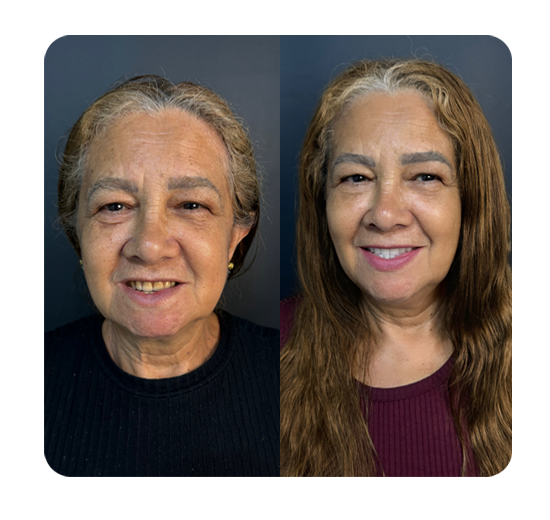 Slide_AntesDepois-01