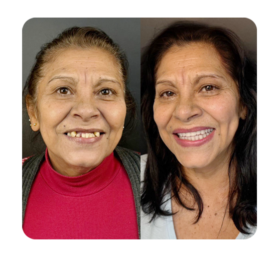 Slide_AntesDepois-02