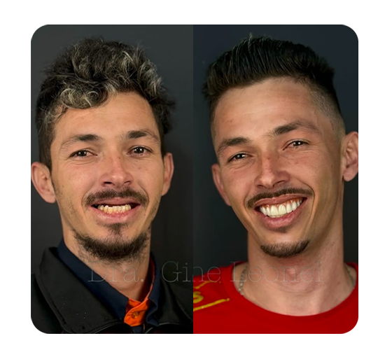 Slide_AntesDepois-03