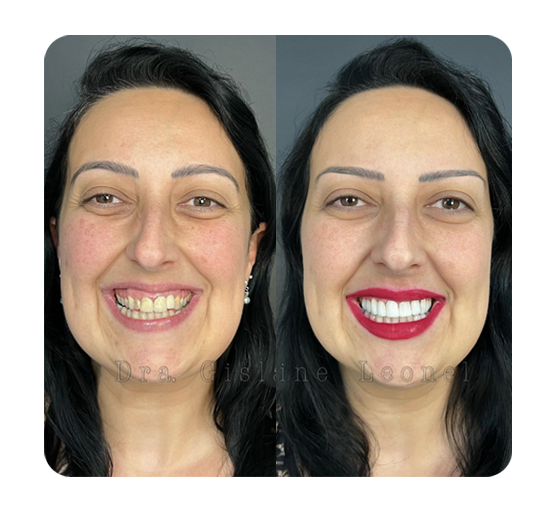 Slide_AntesDepois-04