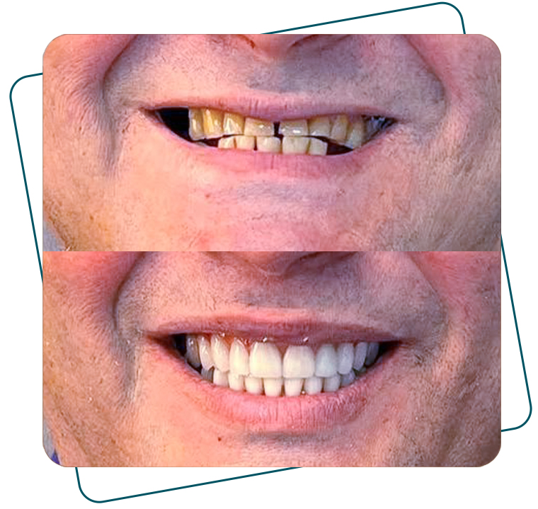 Slide_AntesDepois_B_01