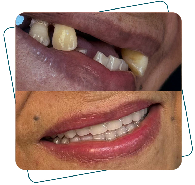 Slide_AntesDepois_B_02