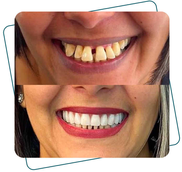 Slide_AntesDepois_B_03