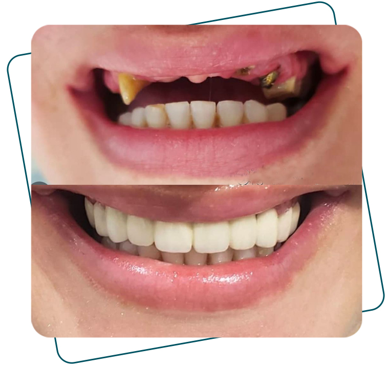 Slide_AntesDepois_B_04